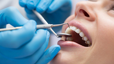 Скуловая имплантация в клинике American Dental