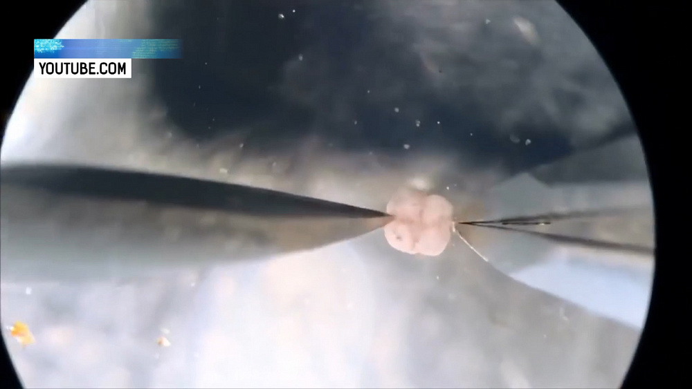 Ученые создали ксенобота