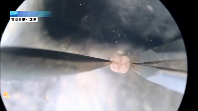 Ученые создали ксенобота