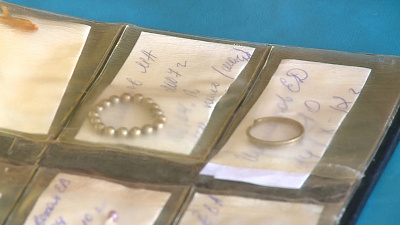 Тикает в животе: коллекция инородных тел Эндоскопического отделения