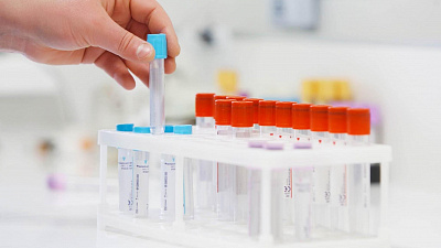 Высокие значения онкомаркера: что делать дальше и как не волноваться