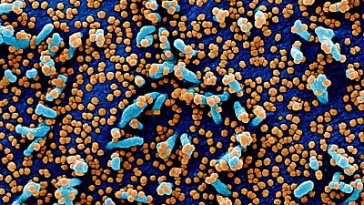 В Челябинской области выросло количество вылечившихся от коронавируса