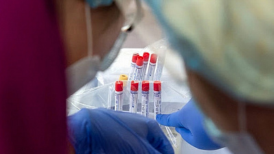 Жителей Челябинской области протестируют на наличие антител к COVID-19