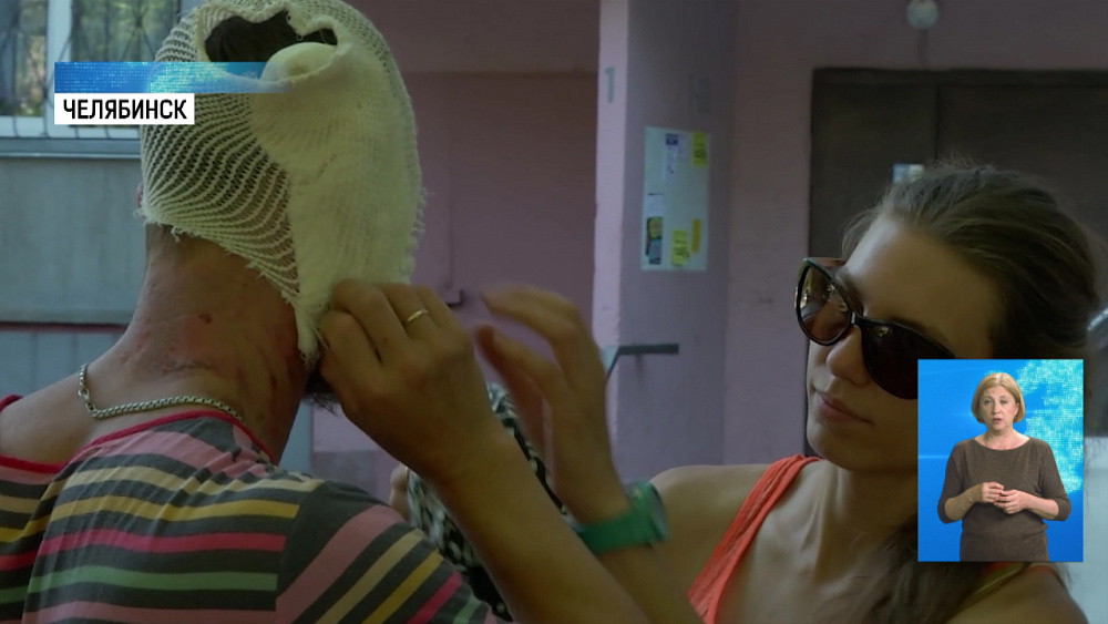 Мужчина обгорел у робота с бензином