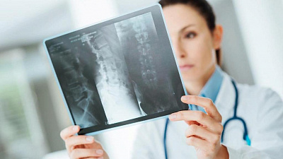 Сервис по анализу рентгеновских снимков и КТ могут запустить в Челябинской области