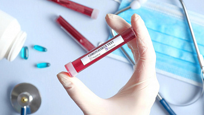 В Челябинской области зарегистрировано 134 новых случая заболевания COVID-19