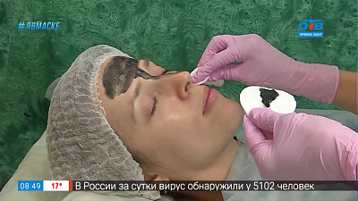 Фейс — контроль — карбоновый пилинг