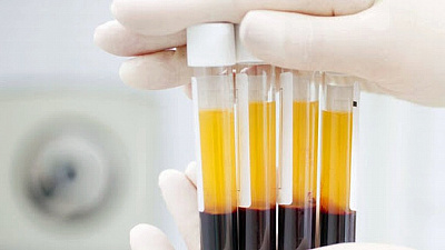 Переболевшие коронавирусом жители Челябинской области получат деньги за сдачу плазмы