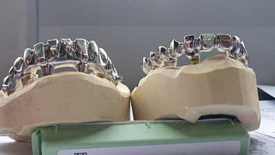 В Челябинске запустили производство комплектующих для зубных имплантатов