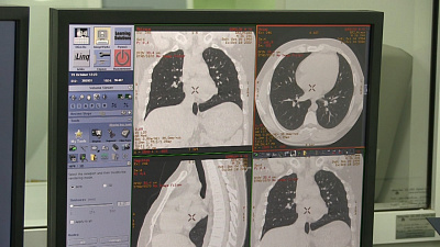 В Миассе начали обследовать пациентов на аппарате КТ