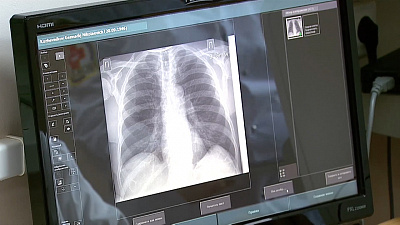 О здоровье 31.10.2020