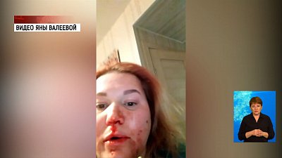 Озерчанке сломали нос за комментарий