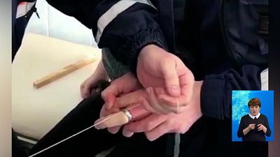 Школьнику помогли снять деталь с пальца